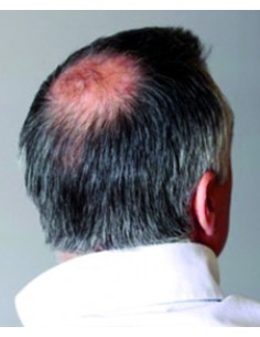 Blum Secret Densificador... 2